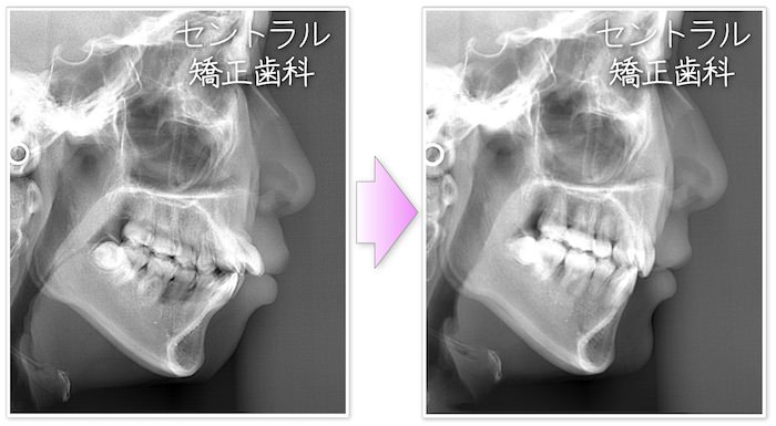 E-Line X-ray